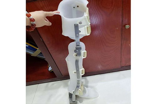 假肢與矯形器的使用周期與更換指南 科學(xué)維護(hù)，保障生活品質(zhì)